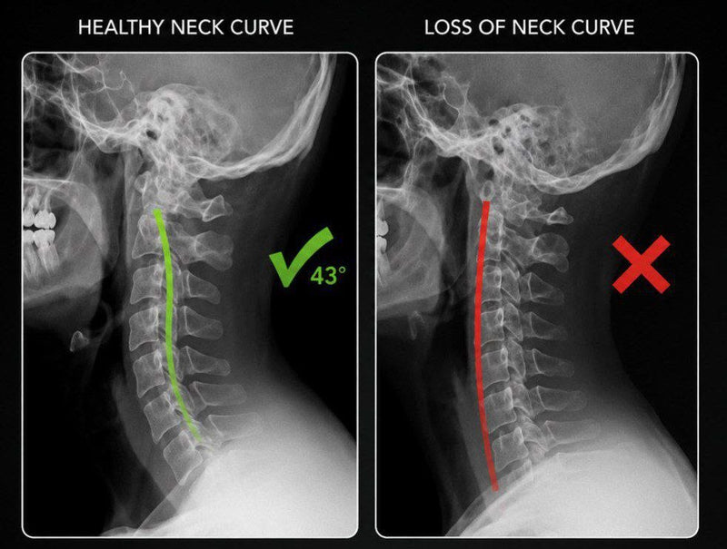 2.Your Neck Can Stay Under Pressure for Hours